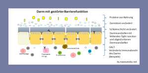 Grafik: Defekte Darmbarriere , veränderte Bakterienzusammensetzung. Bei einer geschädigten Darmbarriere können Nahrungsbestandteile und Mikroorganismen in durch den Darm in die Körperhöhle gelangen.