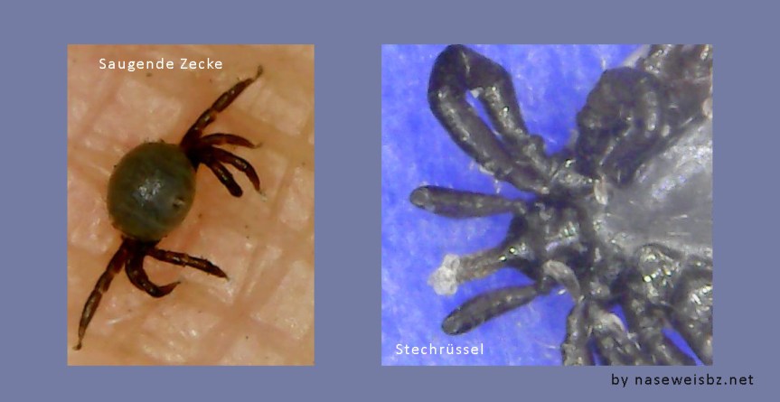 Molekulares Mimikry: Beispiel SDU und&nbsp;Borreliose